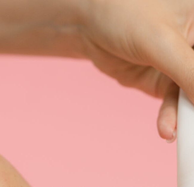 ihottuma - TSW-ihottuma: Kun kortisonivoiteet kääntyvät ihoa vastaan